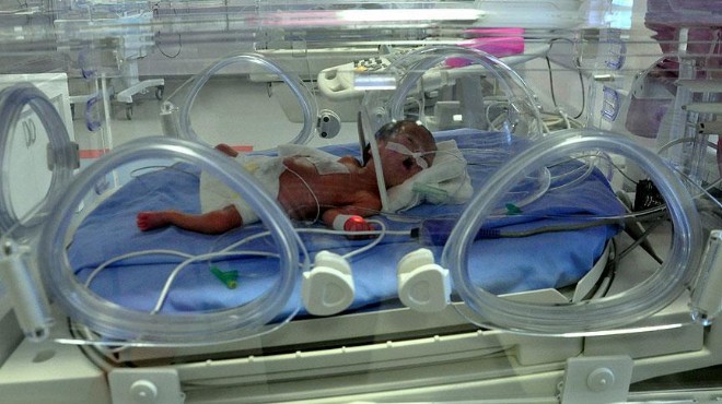  Her 10 bebekten biri prematüre doğuyor 