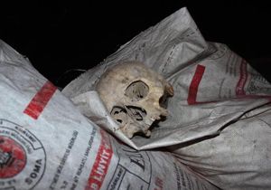 Çöpte bulunan kafatasının sırrı ortaya çıktı