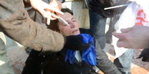 Silivri’de gözünden yaralanan İzmirli kadın konuştu