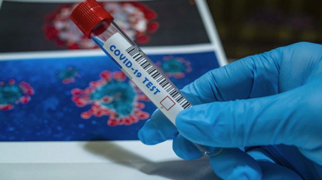 Dünya genelinde koronavirüs tespit edilen kişi sayısı 7 milyonu geçti