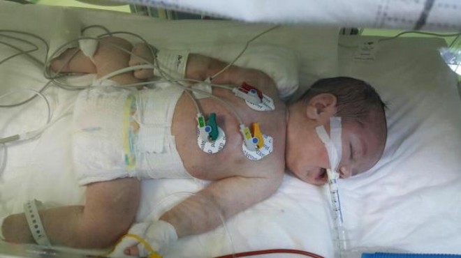‘Ebe krizi kurbanı’ bebek 76 gün dayanabildi
