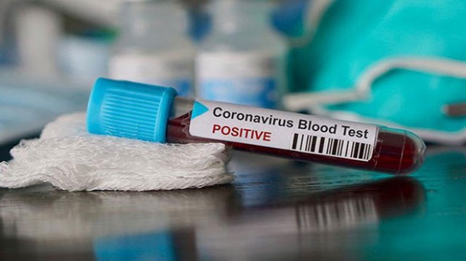 İran’da koronavirüs 121 can daha aldı