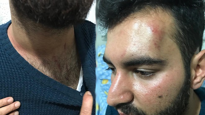 İzmir de şok iddia: Belediye başkan aday adayı kahvede adam dövdü!