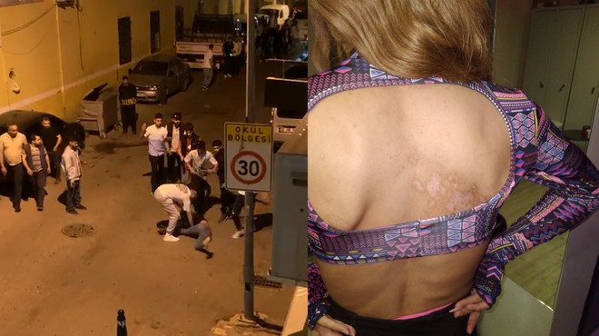İzmir de trans kadına saldırı!