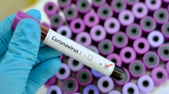 İzmir’deki üç sağlıkçının koronavirüs testinden ne sonuç çıktı?