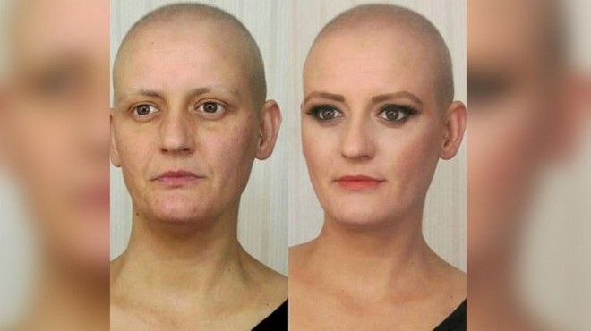 Kanserli hastayı oynadı, 9 ay sonra kanser...
