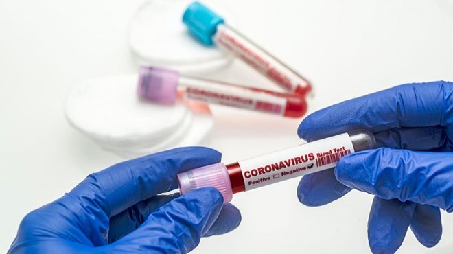 Koronavirüs nedeniyle son 24 saatte 75 ölüm 2 bin 198 yeni vaka!