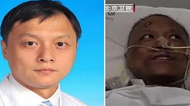 Ten rengi değişen Çinli doktordan acı haber!