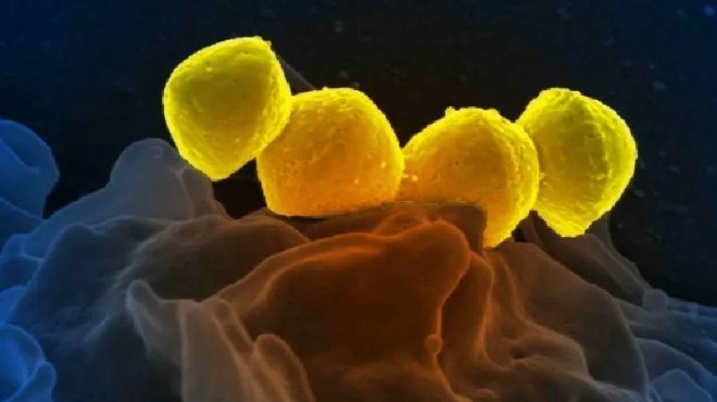  Et yiyen  bakteri tehlikesi: Yayılmaya başladı!