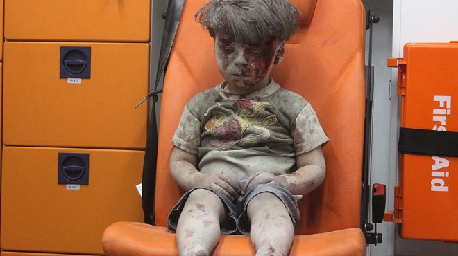  Halep te Ümran gibi 100 binden fazla çocuk var 