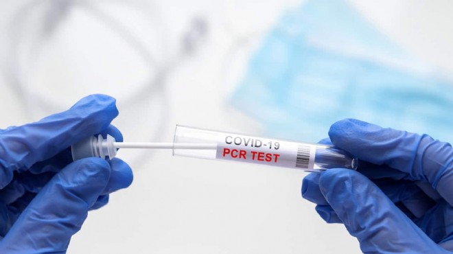 300 TL ye negatif PCR testi iddiasına şirketten yalanlama