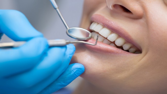 Beslenme düzeni dişlerdeki sararmayı etkiliyor