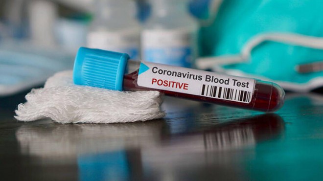 Koronavirüs testi evde yapılır mı?