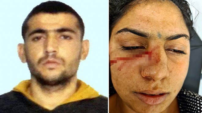 Kahvaltı yüzünden eşini bıçaklayan kişi tutuklandı