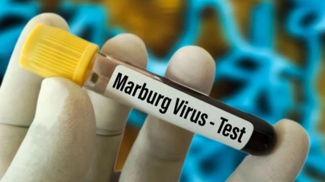 Körfez ülkelerinden  Marburg virüsü  uyarısı
