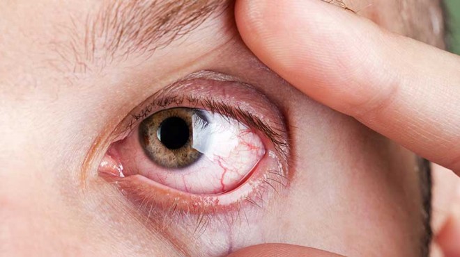Retina hastalıkları körlüğe neden oluyor