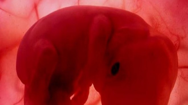 Tıpta bir ilk: İnsan ve domuzdan karma embriyo üretildi