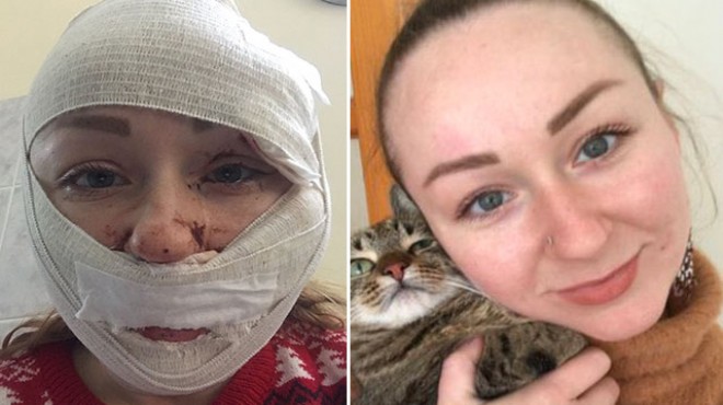 Ukraynalı kadını falçatayla saldıran kocası tutuklandı